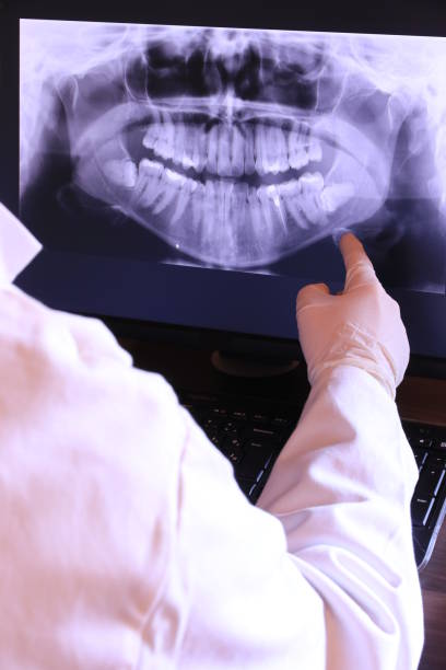 Best Emergency Root Canal Treatment in East Hills, NY